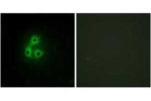 Immunofluorescence analysis of A549 cells, using CSK Antibody. (CSK 抗体  (AA 31-80))