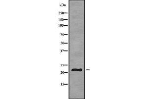 Western blot analysis GP1BB using HeLa whole cell lysates (GP1BB 抗体)