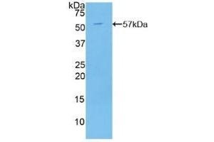 Detection of Recombinant C2CD3, Human using Polyclonal Antibody to C2 Calcium Dependent Domain Containing Protein 3 (C2CD3) (C2CD3 抗体  (AA 1432-1647))