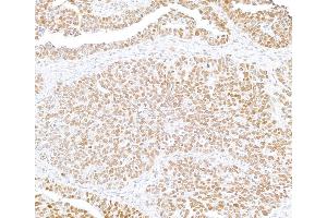 Immunohistochemistry (IHC) image for anti-SWI/SNF Related, Matrix Associated, Actin Dependent Regulator of Chromatin, Subfamily B, Member 1 (SMARCB1) (AA 225-275) antibody (ABIN7795716)