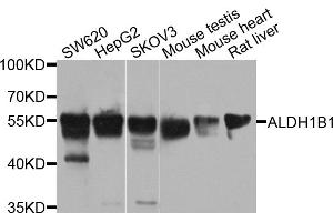Western blot analysis of extracts of various cell lines, using ALDH1B1 antibody (ABIN5971915) at 1/1000 dilution. (ALDH1B1 抗体)