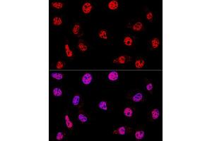Confocal immunofluorescence analysis of L929 cells using HD Polyclonal Antibody (ABIN3020753, ABIN3020754, ABIN3020755 and ABIN6213707) at dilution of 1:200. (HDAC1 抗体  (AA 393-482))