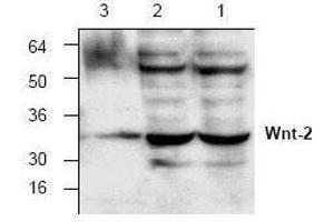 Image no. 1 for anti-Wingless-Type MMTV Integration Site Family Member 2 (WNT2) antibody (ABIN127198) (WNT2 抗体)