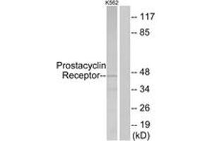 Western blot analysis of extracts from K562 cells, using Prostacyclin Receptor Antibody. (Prostacyclin Receptor 抗体  (AA 198-247))
