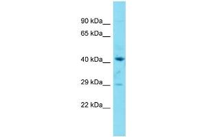 Host:  Rabbit  Target Name:  Ptges2  Sample Type:  Mouse Spleen lysates  Antibody Dilution:  1. (PTGES2 抗体  (Middle Region))