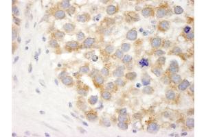 Immunohistochemistry (IHC) image for anti-DEAD (Asp-Glu-Ala-Asp) Box Polypeptide 3, X-Linked (DDX3X) (AA 1-50) antibody (ABIN7448520) (DDX3X 抗体  (AA 1-50))
