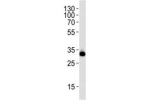 Western blot analysis of lysate from HeLa cell line using RPS6 antibody at 1:1000. (RPS6 抗体  (AA 220-249))