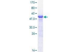 Image no. 1 for Proteasome (Prosome, Macropain) Activator Subunit 1 (PA28 Alpha) (PSME1) (AA 1-249) protein (GST tag) (ABIN1316661) (PSME1 Protein (AA 1-249) (GST tag))