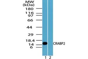 Image no. 2 for anti-Cellular Retinoic Acid Binding Protein 2 (CRABP2) (AA 75-125) antibody (ABIN960117) (CRABP2 抗体  (AA 75-125))