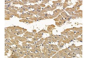 ABIN7093773 and ABIN7097814 at 1/100 staining rat heart tissue by IHC-P.