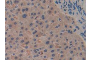 DAB staining on IHC-P; Samples: Human Liver Tissue (RPN1 抗体  (AA 180-307))