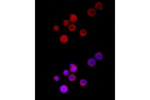 Immunofluorescence analysis of Neuro-2a cells using TRPC5 Rabbit pAb (ABIN6128835, ABIN6149578, ABIN6149579 and ABIN6214219) at dilution of 1:150 (40x lens). (TRPC5 抗体  (AA 764-973))