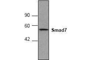 Image no. 1 for anti-SMAD, Mothers Against DPP Homolog 7 (SMAD7) antibody (ABIN127302) (SMAD7 抗体)
