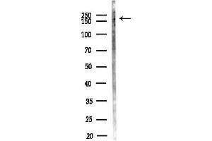 anti-Smg-6 Homolog, Nonsense Mediated mRNA Decay Factor (SMG6) (N-Term) antibody