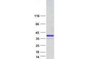 Validation with Western Blot