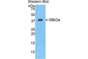 Western blot analysis of the recombinant protein. (FBLN4 抗体  (AA 136-225))