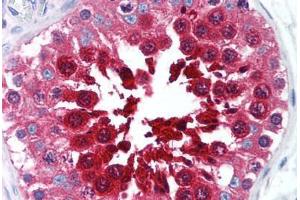 Human Testis (formalin-fixed, paraffin-embedded) stained with TPX2 antibody ABIN239857 at 10 ug/ml followed by biotinylated anti-mouse IgG secondary antibody ABIN481714, alkaline phosphatase-streptavidin and chromogen. (TPX2 抗体  (AA 1-220))