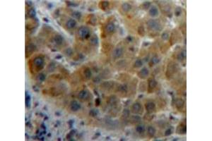 Used in DAB staining on fromalin fixed paraffin-embedded Liver tissue (RBP1 抗体  (AA 2-135))
