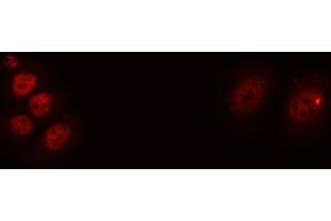 ABIN6276654 staining A549 cells by ICC/IF. (BDNF 抗体  (Internal Region))