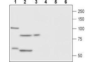Western blot analysis of rat ovary (lane 1 and 4), rat testis (lane 2 and 5) and human OVCAR3 cell line (lane 3 and 6) lysates:1-3. (Follicle Stimulating Hormone Receptor (FSHR) Peptide)
