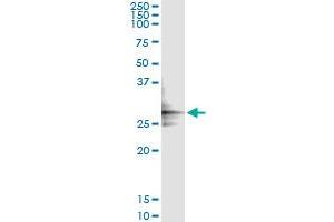 Immunoprecipitation of GLUD2 transfected lysate using anti-GLUD2 monoclonal antibody and Protein A Magnetic Bead , and immunoblotted with GLUD2 MaxPab rabbit polyclonal antibody. (GLUD2 抗体  (AA 1-264))