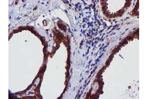 Immunohistochemical staining of paraffin-embedded Human breast tissue using anti-EPN2 mouse monoclonal antibody. (Epsin 2 抗体)