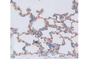 Used in DAB staining on fromalin fixed paraffin- embedded Kidney tissue