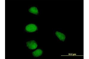Immunofluorescence of purified MaxPab antibody to CCNE1 on HeLa cell. (Cyclin E1 抗体  (AA 1-410))