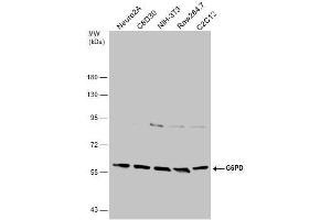 WB Image Various whole cell extracts (30 μg) were separated by 7. (Glucose-6-Phosphate Dehydrogenase 抗体)