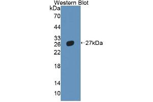 Western blot analysis of the recombinant protein. (NR5A2 + LRH1 抗体  (AA 1-205))