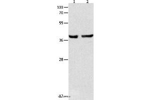 Western blot analysis of Mouse esophagus and human cervical cancer tissue , using SERPINB5 Polyclonal Antibody at dilution of 1:1000 (SERPINB5 抗体)