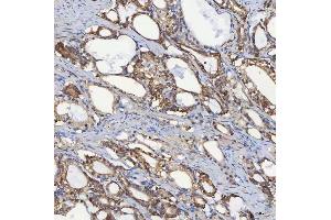 IHC analysis of SEC31A using anti-SEC31A antibody (ABIN7599630).