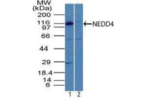 Image no. 1 for anti-Neural Precursor Cell Expressed, Developmentally Down-Regulated 4, E3 Ubiquitin Protein Ligase (NEDD4) (AA 200-250) antibody (ABIN960274) (NEDD4 抗体  (AA 200-250))