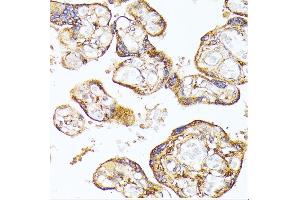 Immunohistochemistry (IHC) image for anti-Fms-Related tyrosine Kinase 1 (VEGFR1) (FLT1) (AA 20-300) antibody (ABIN6140687)