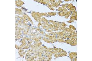 Immunohistochemistry of paraffin-embedded mouse heart using IL20 antibody (ABIN5973987) at dilution of 1/100 (40x lens). (IL-20 抗体)