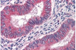 Human Uterus: Formalin-Fixed, Paraffin-Embedded (FFPE)