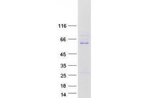 Western Blotting (WB) image for Zinc Finger and SCAN Domain Containing 21 (Zscan21) protein (Myc-DYKDDDDK Tag) (ABIN2736178)