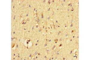 Immunohistochemistry of paraffin-embedded human brain tissue using ABIN7161472 at dilution of 1:100 (Neurotrypsin 抗体  (AA 631-874))