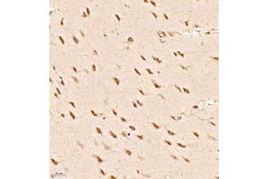 Immunohistochemistry of paraffin embedded rat brain using RBAK (ABIN7075383) at dilution of 1:1000 (400x lens) (RBAK 抗体)