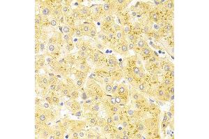 Immunohistochemistry (IHC) image for anti-Wilms Tumor 1 (WT1) (AA 1-302) antibody (ABIN3021698) (WT1 抗体  (AA 1-302))