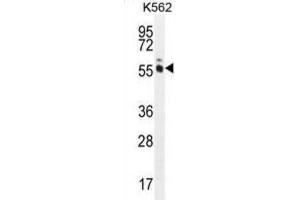 Western Blotting (WB) image for anti-MAGE-Like 2 (MAGEL2) antibody (ABIN3002537) (MAGE-Like 2 抗体)