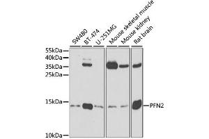 Western blot analysis of extracts of various cell lines, using PFN2 antibody. (PFN2 抗体)