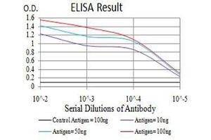 Black line: Control Antigen (100 ng),Purple line: Antigen (10 ng), Blue line: Antigen (50 ng), Red line:Antigen (100 ng) (eIF4EBP1 抗体  (pSer65))