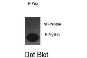 Dot blot analysis of JUN (phospho S63) polyclonal antibody  on nitrocellulose membrane. (C-JUN 抗体  (pSer63))