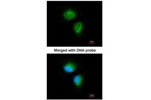 ICC/IF Image Immunofluorescence analysis of paraformaldehyde-fixed HeLa, using MMACHC, antibody at 1:100 dilution. (MMACHC 抗体  (Center))