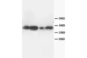 Lane 1: Rat Brain tissue lysate.