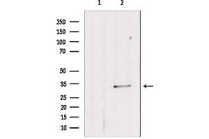 Western blot analysis of extracts from mouse lung, using SULT1E1 antibody. (SULT1E1 抗体  (Internal Region))