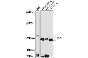 Western blot analysis of extracts of various cell lines, using PKP2 antibody (ABIN6128554, ABIN6145717, ABIN6145718 and ABIN6221177) at 1:1000 dilution. (Plakophilin 2 抗体  (AA 578-837))