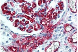 Human Kidney, Endothelium (formalin-fixed, paraffin-embedded) stained with CD34 antibody ABIN305772 at 5 ug/ml followed by biotinylated anti-mouse IgG secondary antibody ABIN481714, alkaline phosphatase-streptavidin and chromogen. (CD34 抗体)
