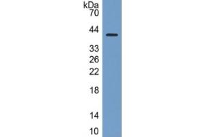 Rabbit Detection antibody from the kit in WB with Positive Control: Sample Human A549 cell lysate.